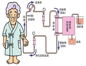 【健康科普】关于血液净化的那些事！